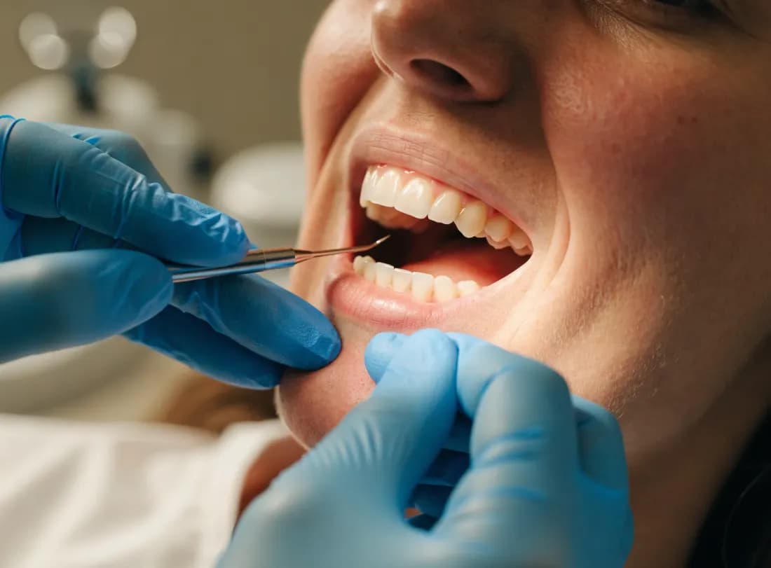 Root canal treatment